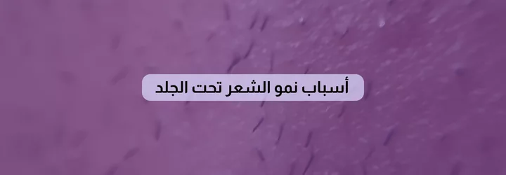 أسباب نمو الشعر تحت الجلد 1