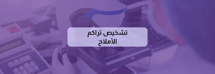 كيف أتخلص من الأملاح في الجسم 7 كيف أتخلص من الأملاح في الجسم 6
