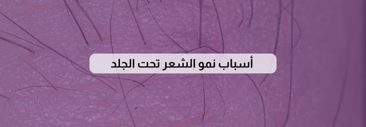 علاج نمو الشعر تحت الجلد