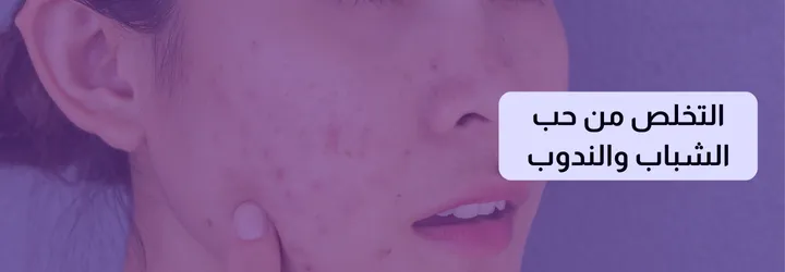 فوائد صابونة الكركم للجسم 4 فوائد صابونة الكركم للجسم 3